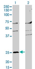 MS4A2 Monoclonal Antibody (3B1)
