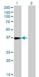 FCER2 Antibody in Western Blot (WB)