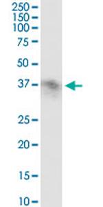 FCGR2B Antibody in Western Blot (WB)