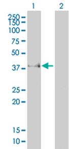 FCGR2B Antibody in Western Blot (WB)