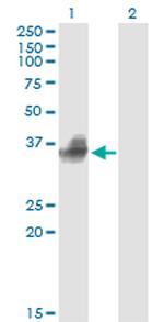 FCGR2B Antibody in Western Blot (WB)