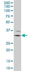 FCGR3A Antibody in Western Blot (WB)