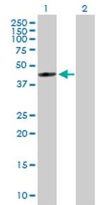 FDFT1 Polyclonal Antibody, MaxPab™