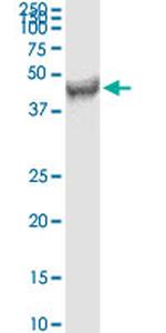 FDFT1 Monoclonal Antibody (3C2)