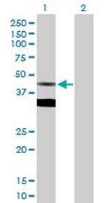FDPS Polyclonal Antibody, MaxPab™