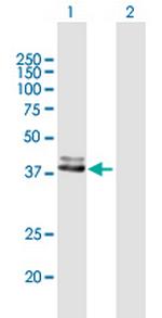 FECH Polyclonal Antibody, MaxPab™