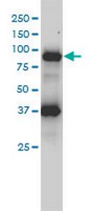 FES Antibody in Western Blot (WB)