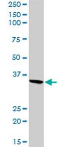 FGA Antibody in Western Blot (WB)