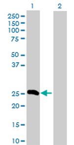 FGA Antibody in Western Blot (WB)