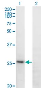 FGA Monoclonal Antibody (1D12)