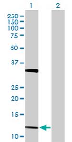 FGF5 Antibody in Western Blot (WB)