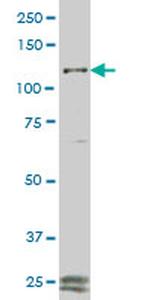 FGFR1 Antibody in Western Blot (WB)