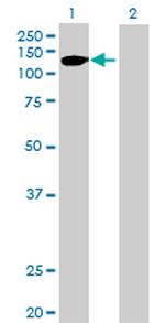 FGFR2 Polyclonal Antibody, MaxPab™