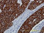 FGFR2 Monoclonal Antibody (1G3)
