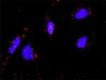 FGFR4 Antibody in Proximity Ligation Assay (PLA) (PLA)