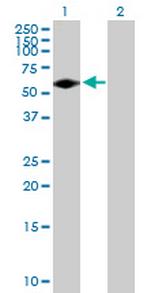 FGR Antibody in Western Blot (WB)