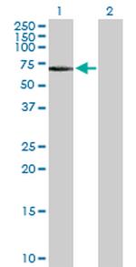 FGR Antibody in Western Blot (WB)