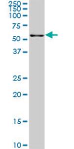 FGR Antibody in Western Blot (WB)