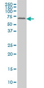 FGR Antibody in Western Blot (WB)