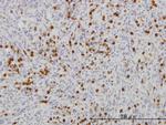 FGR Monoclonal Antibody (1B12)