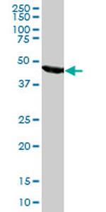 FH Monoclonal Antibody (5D8)
