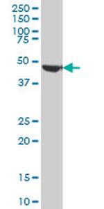 FH Antibody in Western Blot (WB)
