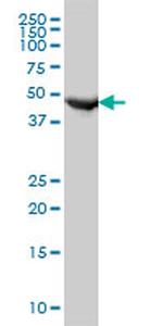 FH Antibody in Western Blot (WB)