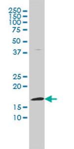 FHIT Monoclonal Antibody (1E3)
