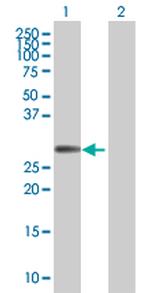 FHL1 Antibody in Western Blot (WB)