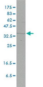 FHL2 Antibody in Western Blot (WB)