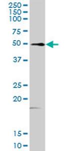 FKBP4 Antibody in Western Blot (WB)