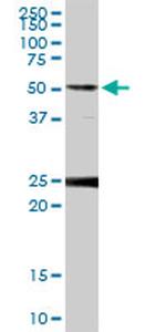 FKBP4 Antibody in Western Blot (WB)