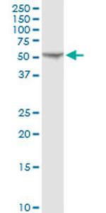 FKBP4 Antibody in Western Blot (WB)