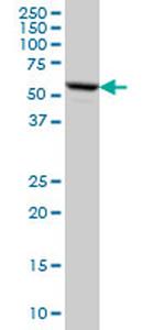 FKBP4 Antibody in Western Blot (WB)