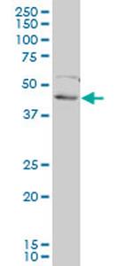FOXF2 Monoclonal Antibody (2D7)