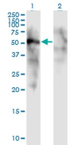 FOXD1 Monoclonal Antibody (2C10)