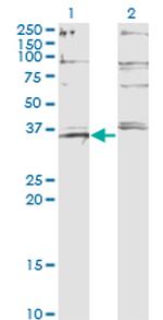 FOXL1 Monoclonal Antibody (2C3)