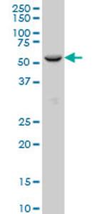 FOXC2 Monoclonal Antibody (4B3)