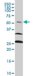 FOXC2 Monoclonal Antibody (4A3)