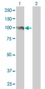 FOXM1 Antibody in Western Blot (WB)