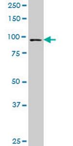 FOXM1 Antibody in Western Blot (WB)