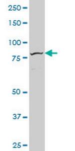 FOXM1 Antibody in Western Blot (WB)