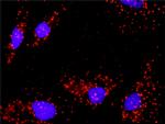 FOXO1A Antibody in Proximity Ligation Assay (PLA) (PLA)