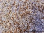 FOXO1A Antibody in Immunohistochemistry (Paraffin) (IHC (P))