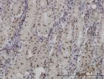 FOXO3A Antibody in Immunohistochemistry (Paraffin) (IHC (P))