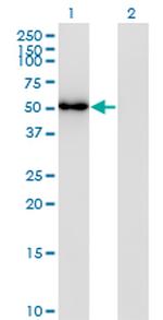 FLI1 Monoclonal Antibody (2G8)