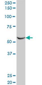 FLI1 Antibody in Western Blot (WB)
