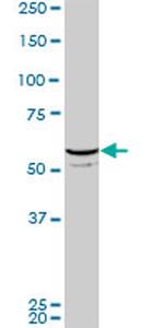 FLI1 Monoclonal Antibody (2D6)