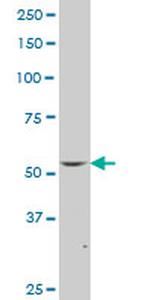 FLI1 Antibody in Western Blot (WB)