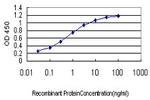 FLT4 Monoclonal Antibody (5B6)